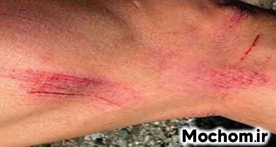 تعبیر خواب زخم صورت امام صادق تعبیر خواب زخم صورت دیگران تعبیر خواب زخمی شدن پا امام صادق تعبیر خواب زخم سر دیگران تعبیر خواب زخم روی بدن مرده چیست تعبیر خواب زخم سر مرده تعبیر خواب ، زخم پای مرده تعبیر خواب ، زخم دست مرده