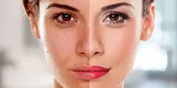 کپسول زیبایی صورت + خواص و کاربرد و بهترین زمان مصرف و عوارض آن