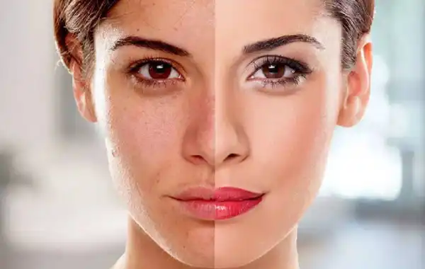 کپسول زیبایی صورت + خواص و کاربرد و بهترین زمان مصرف و عوارض آن