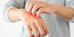 قرص حساسیت پوستی + خواص و کاربرد و بهترین زمان مصرف و عوارض آن