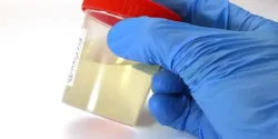 تعبیر خواب ادرار + معنی ادرار در خواب های ما چیست