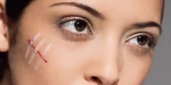 تعبیر خواب صورت زخمی از دید امام صادق و ابن سیرین و حضرت یوسف