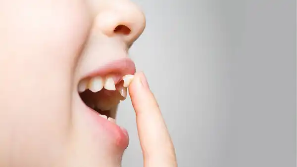 تعبیر خواب ریختن دندان + از دید امام صادق و ابن سیرین و حضرت یوسف